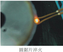 초고주파 1-2Mhz 인덕션 녹화 장비